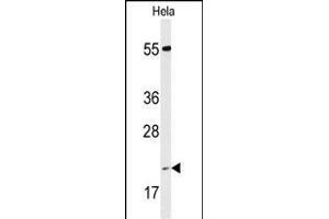 Western blot analysis of IC Antibody (Center) (ABIN653304 and ABIN2842804) in Hela cell line lysates (35 μg/lane). (PPIC 抗体  (AA 61-89))