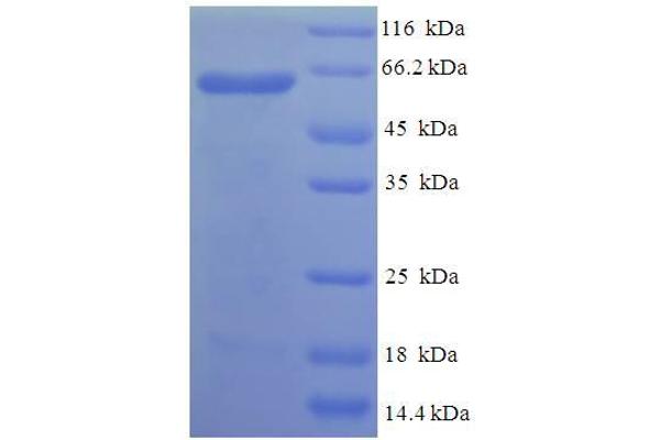 PISD Protein (AA 1-375, Isoform 2) (His-SUMO Tag)