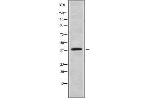 Western blot analysis of HOXC10 using Jurkat whole cell lysates (HOXC10 抗体  (Internal Region))