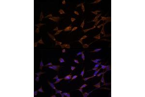 Immunofluorescence analysis of PC-12 cells using [KO Validated] AMPKα2 Rabbit pAb (ABIN6129903, ABIN6146170, ABIN6146172 and ABIN6218273) at dilution of 1:150 (40x lens). (PRKAA2 抗体  (AA 343-552))