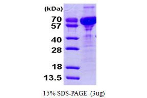 CRNN Protein (AA 1-495) (His tag)