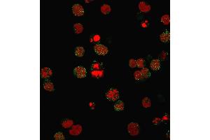 Immunofluorescence (IF) image for anti-Complement Component (3d/Epstein Barr Virus) Receptor 2 (CR2) (AA 142-240) antibody (ABIN6939186)