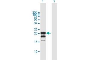 Western Blot analysis of IFNG expression in transfected 293T cell line by IFNG MaxPab polyclonal antibody. (Interferon gamma 抗体  (AA 1-166))
