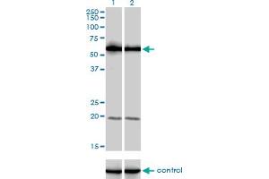 Western Blotting (WB) image for anti-phosphoinositide Kinase, FYVE Finger Containing (PIKFYVE) (AA 342-451) antibody (ABIN566937)