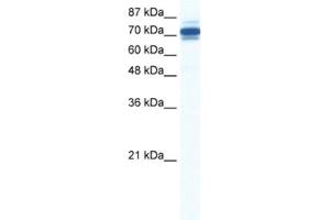 Western Blotting (WB) image for anti-Zinc Finger and SCAN Domain Containing 29 (ZSCAN29) antibody (ABIN2461307) (ZSCAN29 抗体)