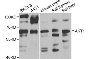 Western blot analysis of extracts of various cell lines, using AKT1 antibody (ABIN5973219) at 1/1000 dilution. (AKT1 抗体)