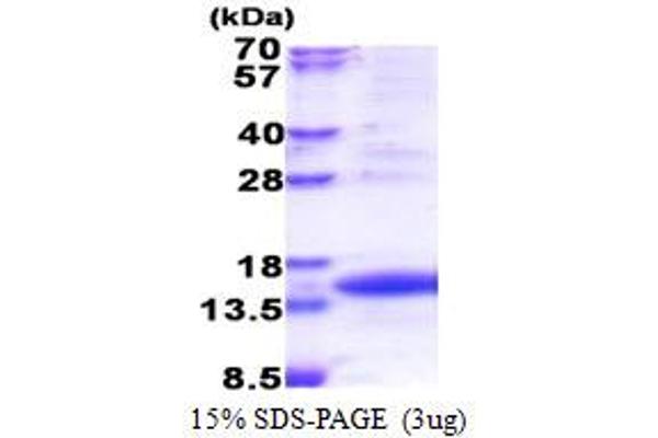 TIMM8A/DDP Protein (AA 1-97) (His tag)