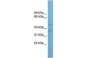 WB Suggested Anti-AADACL4 Antibody Titration: 0. (AADACL4 抗体  (Middle Region))