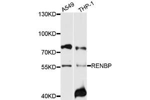 Western blot analysis of extracts of various cell lines, using RENBP antibody (ABIN6003719) at 1/1000 dilution. (RENBP 抗体)
