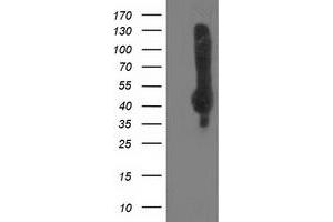 HEK293T cells were transfected with the pCMV6-ENTRY control (Left lane) or pCMV6-ENTRY NEU2 (Right lane) cDNA for 48 hrs and lysed. (NEU2 抗体)