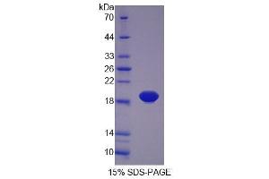 SDS-PAGE analysis of Rat PLTP Protein. (PLTP 蛋白)