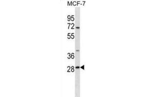 Western Blotting (WB) image for anti-Signal Recognition Particle Receptor, B Subunit (SRPRB) antibody (ABIN2998527) (SRPRB 抗体)