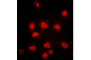 Immunofluorescent analysis of RB1 (pS807) staining in HeLa cells. (Retinoblastoma 1 抗体  (C-Term, pSer807))