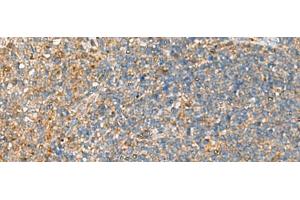 Immunohistochemistry of paraffin-embedded Human tonsil tissue using NQO2 Polyclonal Antibody at dilution of 1:70(x200) (NQO2 抗体)