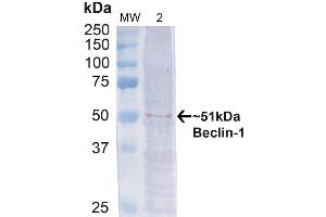 Western blot analysis of Human Cervical cancer cell line (HeLa) lysate showing detection of ~51 kDa Beclin 1 protein using Rabbit Anti-Beclin 1 Polyclonal Antibody (ABIN2868749). (Beclin 1 抗体  (APC))