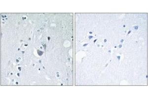 Immunohistochemistry analysis of paraffin-embedded human brain, using SAPK/JNK (Phospho-Tyr185) Antibody. (SAPK, JNK (AA 151-200), (pTyr185) 抗体)