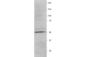 Western Blotting (WB) image for anti-Vimentin (VIM) antibody (ABIN955516) (Vimentin 抗体)