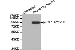 Western blot analysis of extract from 293 cells, using Phospho-IGF1R-Y1280 antibody (ABIN2988067). (IGF1R 抗体  (pTyr1280))