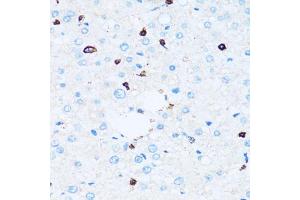 Immunohistochemistry of paraffin-embedded human liver using SPN antibody. (CD43 抗体)