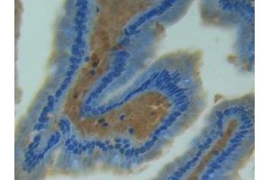 Used in DAB staining on fromalin fixed paraffin- embedded tissue (NOS2 抗体  (AA 43-213))