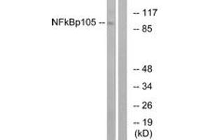 Western Blotting (WB) image for anti-Nuclear Factor of kappa Light Polypeptide Gene Enhancer in B-Cells 1 (NFKB1) (AA 899-948) antibody (ABIN2889032) (NFKB1 抗体  (AA 899-948))