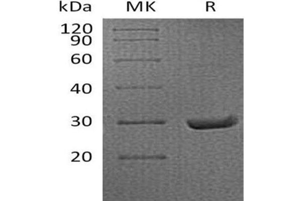 APCS Protein (His tag)