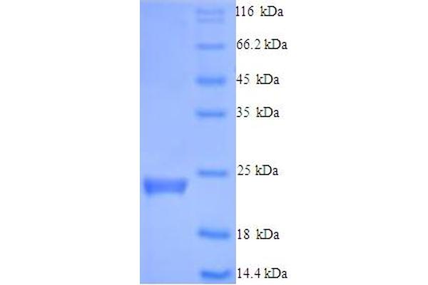 CASP5 Protein (AA 137-327, partial) (His tag)