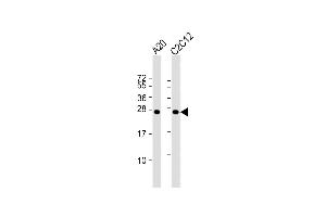 All lanes : Anti-mouse BAD Antibody at 1:1000 dilution Lane 1: A20 whole cell lysate Lane 2: C2C12 whole cell lysate Lysates/proteins at 20 μg per lane. (BAD 抗体  (AA 90-118))