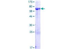 Image no. 1 for Putative Homeodomain Transcription Factor 2 (PHTF2) (AA 1-317) protein (GST tag) (ABIN1314953) (PHTF2 Protein (AA 1-317) (GST tag))