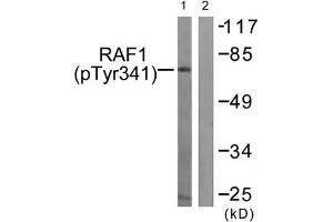 Western blot analysis of extracts from Jurkat cells treated with Paclitaxel using Raf1 (Phospho-Tyr341) Antibody. (RAF1 抗体  (pTyr341))