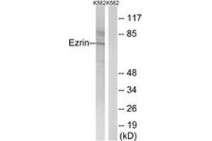 Western Blotting (WB) image for anti-Ezrin (EZR) (AA 446-495) antibody (ABIN2889087) (Ezrin 抗体  (AA 446-495))