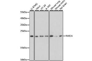 Western blot analysis of extracts of various cell lines, using RAB2A antibody. (RAB2A 抗体)