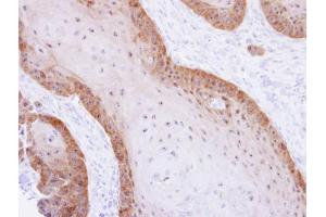 IHC-P Image Immunohistochemical analysis of paraffin-embedded Cal27 xenograft, using XBP1, antibody at 1:500 dilution. (XBP1 抗体)