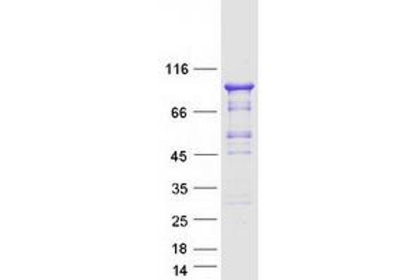 GMEB1 Protein (Transcript Variant 1) (Myc-DYKDDDDK Tag)