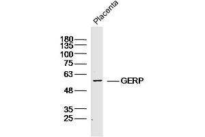 Mouse placenta lysates probed with GERP Polyclonal Antibody, Unconjugated  at 1:300 dilution and 4˚C overnight incubation. (TRIM8 抗体)