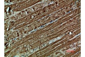 Immunohistochemical analysis of paraffin-embedded human-muscle, antibody was diluted at 1:200 (Cytochrome C 抗体  (AA 1268-1341))