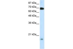 Western Blotting (WB) image for anti-Tripartite Motif Containing 32 (TRIM32) antibody (ABIN2460275) (TRIM32 抗体)