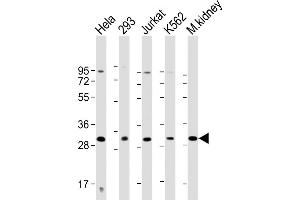 All lanes : Anti-HOXB4 Antibody (Center) at 1:2000 dilution Lane 1: Hela whole cell lysate Lane 2: 293 whole cell lysate Lane 3: Jurkat whole cell lysate Lane 4: K562 whole cell lysate Lane 5: mouse kidney lysate Lysates/proteins at 20 μg per lane. (HOXB4 抗体  (AA 138-171))