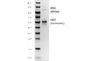 HSA 蛋白