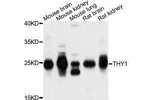 Western blot analysis of extracts of exosome from various cells, using THY1 antibody. (CD90 抗体)
