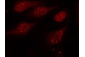 Immunofluorescence staining of methanol-fixed Hela cells, using Phospho-TP53-S315 antibody. (p53 抗体  (pSer315))