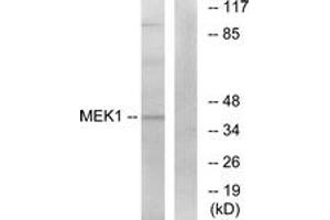 Western blot analysis of extracts from K562 cells, treated with, using MEK1 (Ab-291) Antibody. (MEK1 抗体  (AA 261-310))