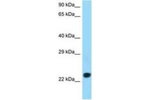 Image no. 1 for anti-CD86 (CD86) (C-Term) antibody (ABIN6747996) (CD86 抗体  (C-Term))