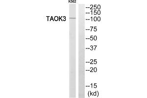 Western blot analysis of extracts from K562 cells, using TAOK3 antibody. (TAO Kinase 3 抗体  (Internal Region))