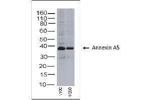 Rabbit anti Annexin A5 on human tonsil lysate (Annexin V 抗体)