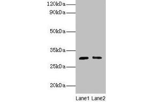 Western blot All lanes: Cd82 antibody at 2 μg/mL Lane 1: Jurkat whole cell lysate Lane 2: A549 whole cell lysate Secondary Goat polyclonal to rabbit IgG at 1/10000 dilution Predicted band size: 30 kDa Observed band size: 30 kDa (CD82 抗体  (AA 111-227))