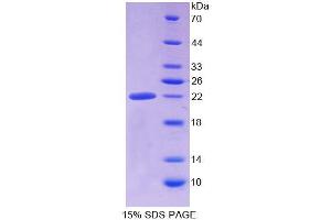 SDS-PAGE analysis of Human ALDH1A3 Protein. (ALDH1A3 蛋白)