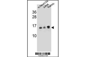 Western blot analysis in mouse Neuro-2a,Jurkat,Ramos cell line lysates (35ug/lane). (UBE2E2 抗体  (N-Term))