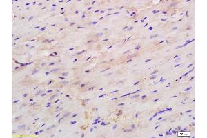 Formalin-fixed and paraffin embedded mouse heart labeled with Rabbit Anti H Cadherin/T cadherin Polyclonal Antibody, Unconjugated (ABIN715271) at 1:200 followed by conjugation to the secondary antibody and DAB staining (Cadherin 13 抗体  (AA 301-400))