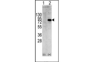 Image no. 1 for anti-Phosphoinositide 3 Kinase, p85 alpha (PI3K p85a) (Tyr580) antibody (ABIN360457) (PIK3R1 抗体  (Tyr580))